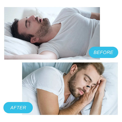 Anti-Snoring Magnetic Nose Strips